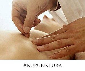 Akupunktura